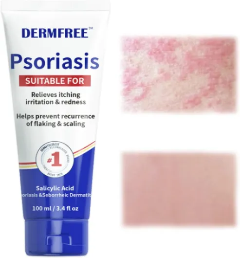 100g Crème de l'eczéma,Crème hydratante,crème de soin pour la peau,Soulagement des zones sèches la peau,Utilisable sur différentes parties du corps 100 g (Lot de 1)