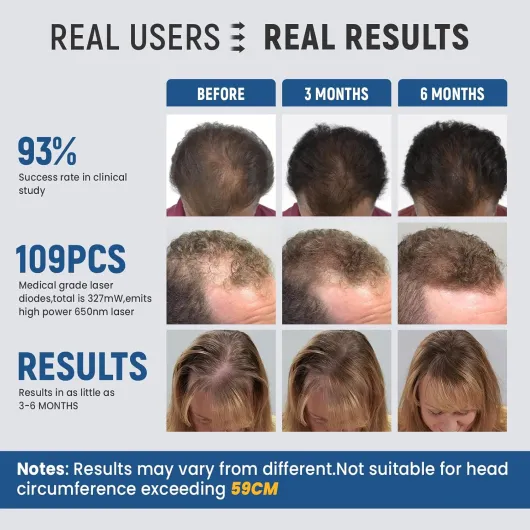 715XqwH2bdL._AC_SL1500_