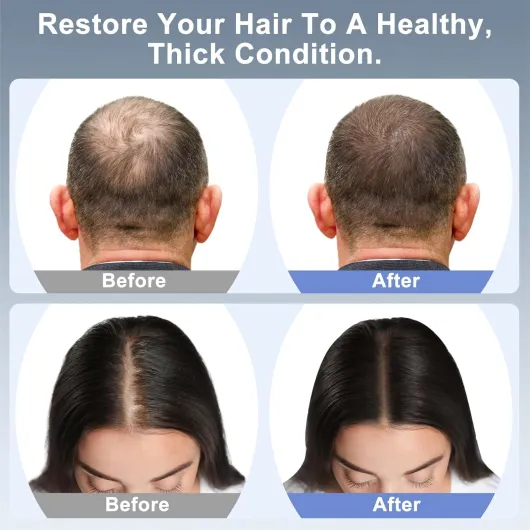 71g7V8rhm4L._AC_SL1500_