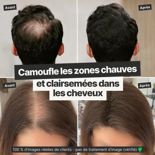 Fibre Capillaire Pour Épaissir les Cheveux & Cheveux Volumineux en Secondes - Poudre Densifiante Cheveux pour un Look Authentique - 100% Naturel! Qualité Salon - 26g (châtain moyen) Châtain 26 g (Lot de 1)