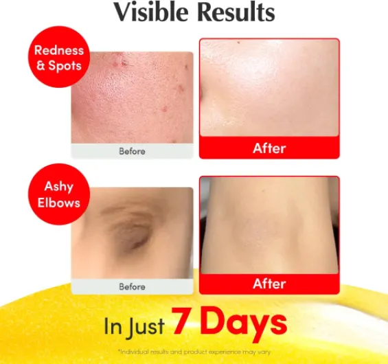 71BmMnxG3wL._AC_SL1500_