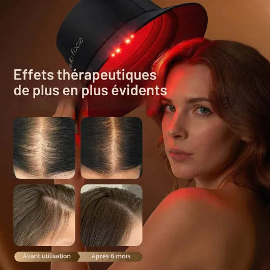 Casquette de thérapie par la lumière rouge, 336 LED 660 nm & 850 nm infrarouge, design chapeau de pêcheur jusqu’à 62 cm, soin capillaire professionnel à domicile